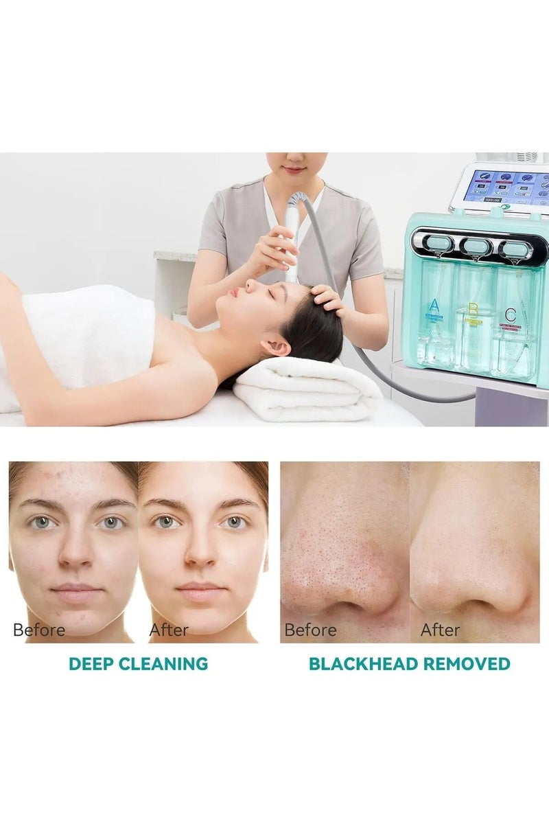 Globalstar 7-in-1 Hydra Facial Machine - Ultimate Skin Rejuvenation and Acne Treatment - Image 2