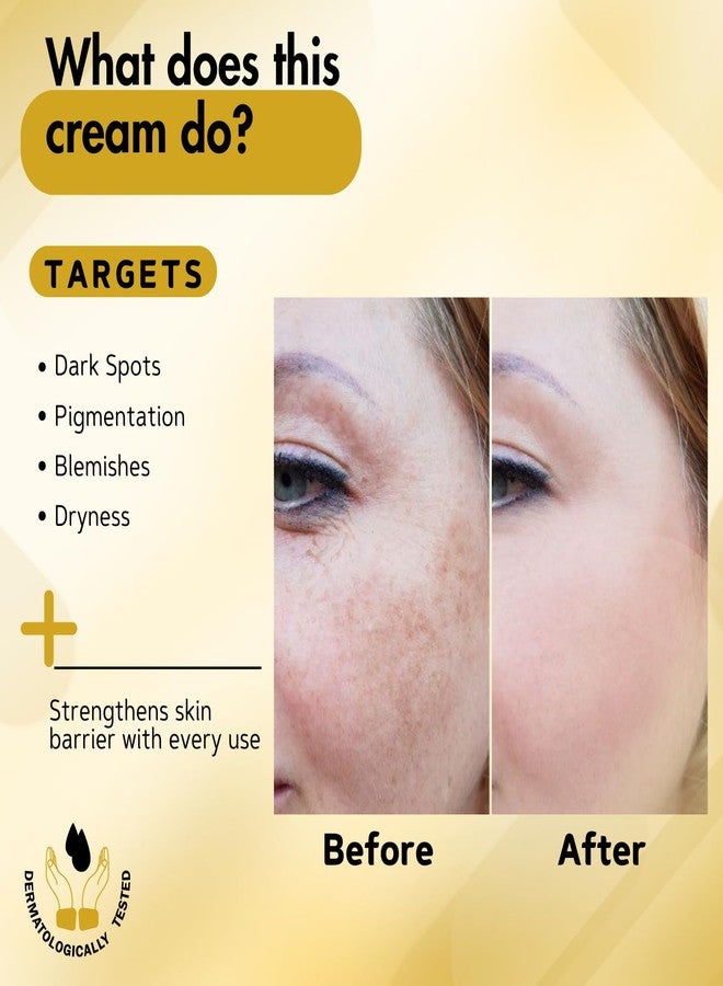 INTIMIFY كريم إنتيميفاي لإزالة البقع الداكنة والتصبغات، كريم لإزالة الشوائب للنساء والرجال 50 غرام (عبوة واحدة) - Image 3