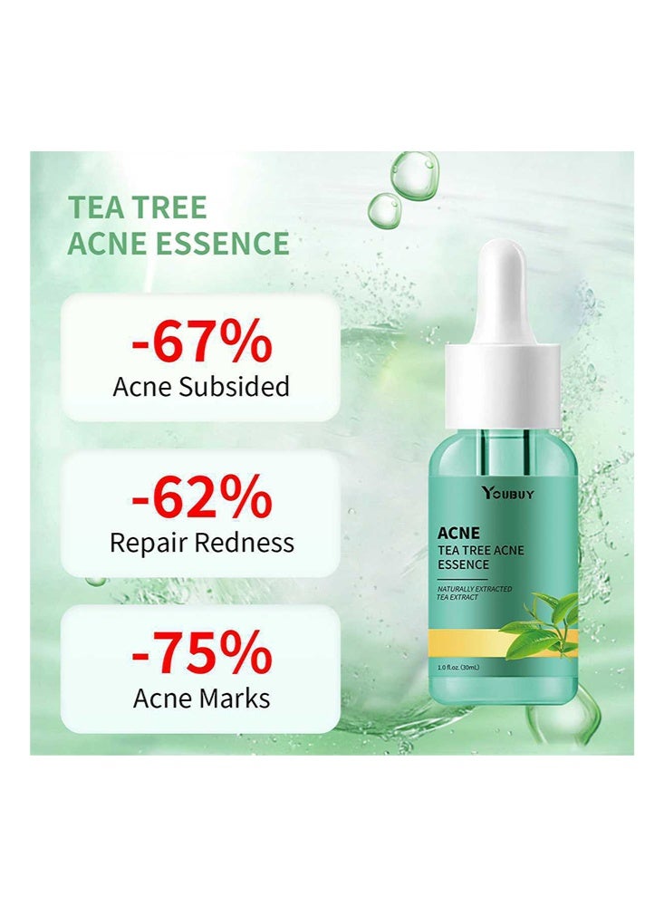 YOUBUY ACNE Tea Tree Acne Essence-Moisturizing Face, Anti-Acne Control Oil , Oil Balance Facial Care 30ml - Image 2