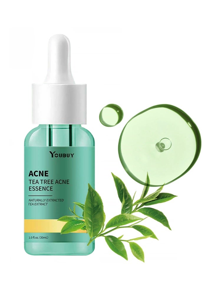 YOUBUY ACNE Tea Tree Acne Essence-Moisturizing Face, Anti-Acne Control Oil , Oil Balance Facial Care 30ml - Image 1