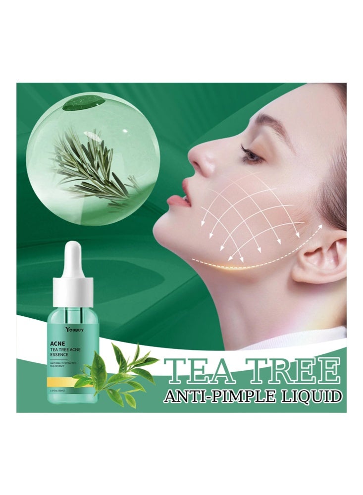 YOUBUY ACNE Tea Tree Acne Essence-Moisturizing Face, Anti-Acne Control Oil , Oil Balance Facial Care 30ml - Image 4