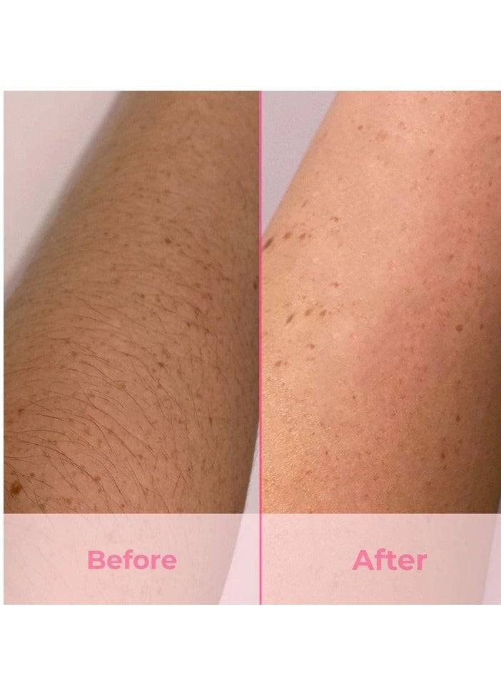 Mini Handheld Laser Hair Remover White - Image 2