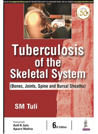 Tuberculosis of the Skeletal System - pzsku/ZCF66D3A1794A1BEB9900Z/45/_/1744118613/954336c8-2cbc-47a0-ad7e-70b117132f38