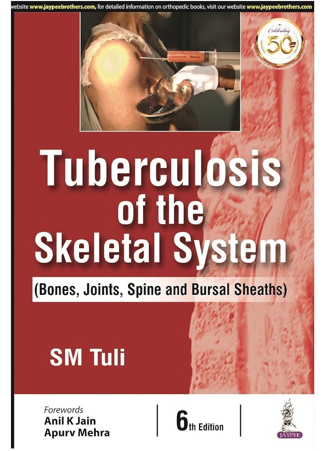 Tuberculosis of the Skeletal System 