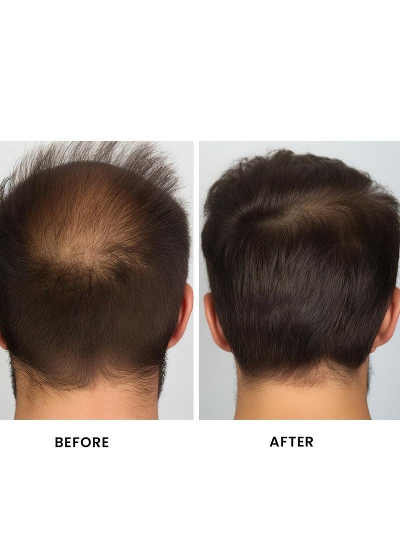 Organic 100% Natural Batana Oil for Hair Growth by , Organic, Unrefined Batana Oil for Visibly Thicker and Stronger Hair, Dr Sebi Approved, for all Hair Types （3.4oz/100ml)  - Image 4