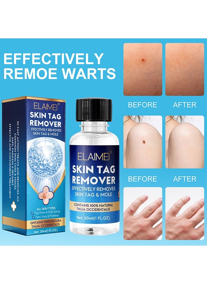Elaimei Skin Tag Remover Mole Remover Effectively Removes Skin Tag And Mole Quick Results And Effective All Natural Extract Suitable For All Skin Types Easy Use At Home 30ML  - Image 2