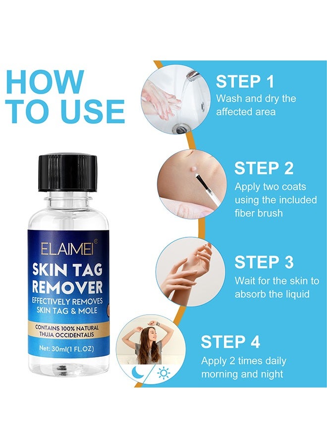 Skin Tag Remover Mole Remover Effectively Removes Skin Tag And Mole Quick Results And Effective All Natural Extract Suitable For All Skin Types Easy Use At Home 30ML