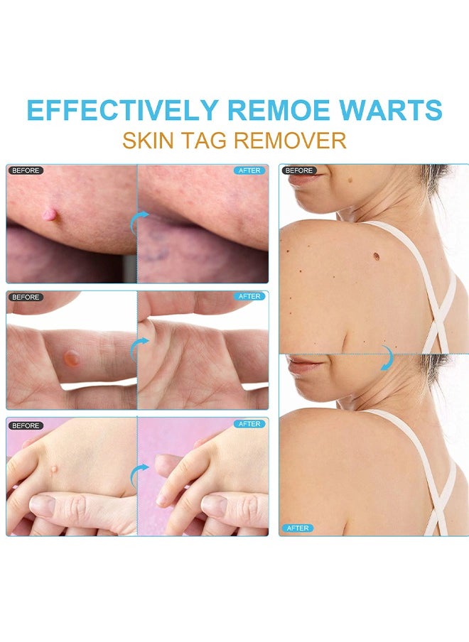 Elaimei Skin Tag Remover Mole Remover Effectively Removes Skin Tag And Mole Quick Results And Effective All Natural Extract Suitable For All Skin Types Easy Use At Home 30ML  - Image 4