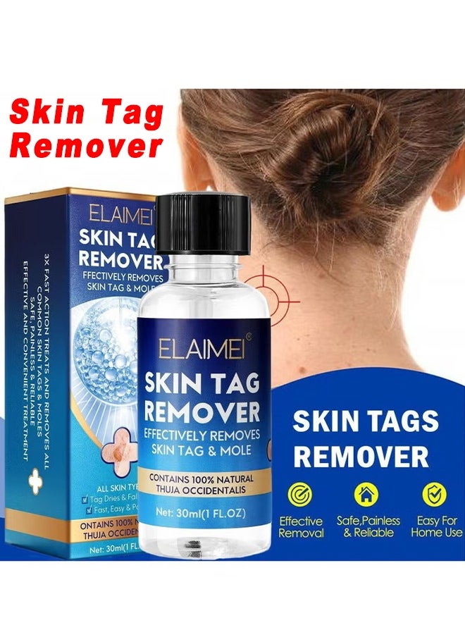 Skin Tag Remover Mole Remover Effectively Removes Skin Tag And Mole Quick Results And Effective All Natural Extract Suitable For All Skin Types Easy Use At Home 30ML