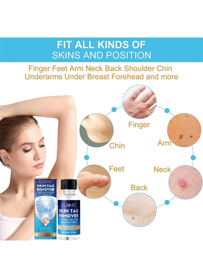 Elaimei Skin Tag Remover Mole Remover Effectively Removes Skin Tag And Mole Quick Results And Effective All Natural Extract Suitable For All Skin Types Easy Use At Home 30ML  - Image 5