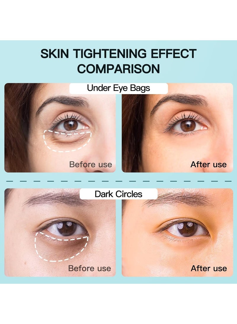 عام جهاز تجميل العين، جهاز مكافحة الشيخوخة، يشد البشرة، يزيل التجاعيد الأنفية، ويقلل من انتفاخ العين السفلي، والهالات السوداء، والخطوط العريضة، والتجاعيد، والخطوط الدقيقة. - Image 3