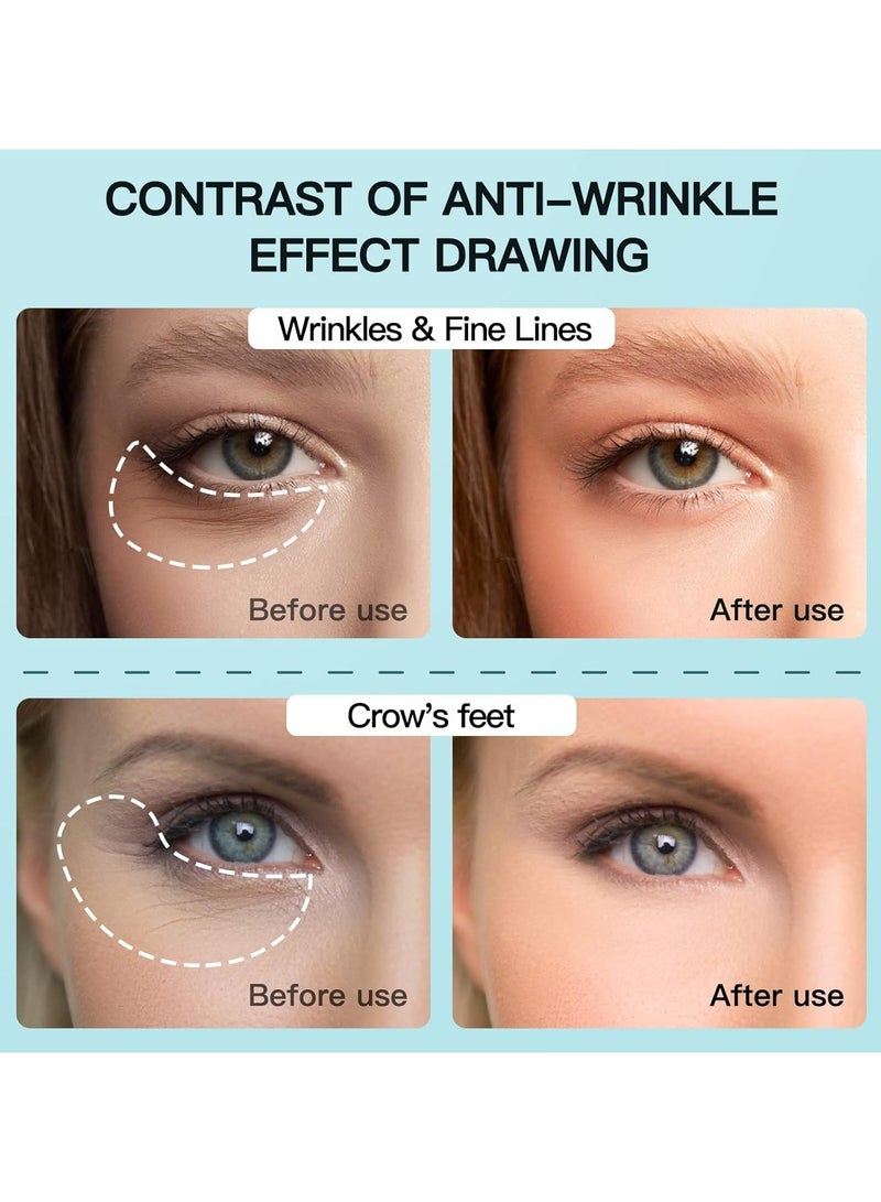 عام جهاز تجميل العين، جهاز مكافحة الشيخوخة، يشد البشرة، يزيل التجاعيد الأنفية، ويقلل من انتفاخ العين السفلي، والهالات السوداء، والخطوط العريضة، والتجاعيد، والخطوط الدقيقة. - Image 4