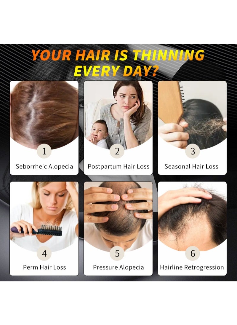 lansiyi - A+B Mixed Hair Regrowth Kit,5% Minoxidil and 8% Ginger Hair Growth Essential Oil for Men and Women,Hair Regrowth Treatment Serum for Stronger Thicker Longer Hair,Help to Stop Thinning and Hair Loss - Image 1