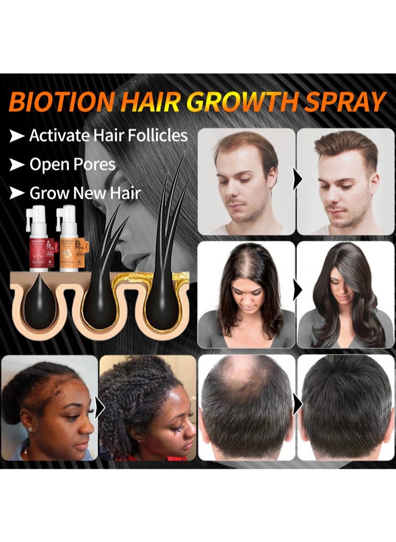 lansiyi - A+B Mixed Hair Regrowth Kit,5% Minoxidil and 8% Ginger Hair Growth Essential Oil for Men and Women,Hair Regrowth Treatment Serum for Stronger Thicker Longer Hair,Help to Stop Thinning and Hair Loss - Image 1