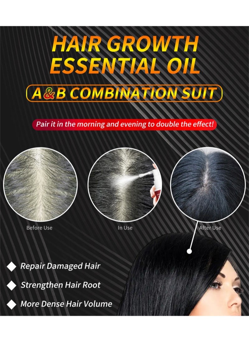 lansiyi - A+B Mixed Hair Regrowth Kit,5% Minoxidil and 8% Ginger Hair Growth Essential Oil for Men and Women,Hair Regrowth Treatment Serum for Stronger Thicker Longer Hair,Help to Stop Thinning and Hair Loss - Image 1