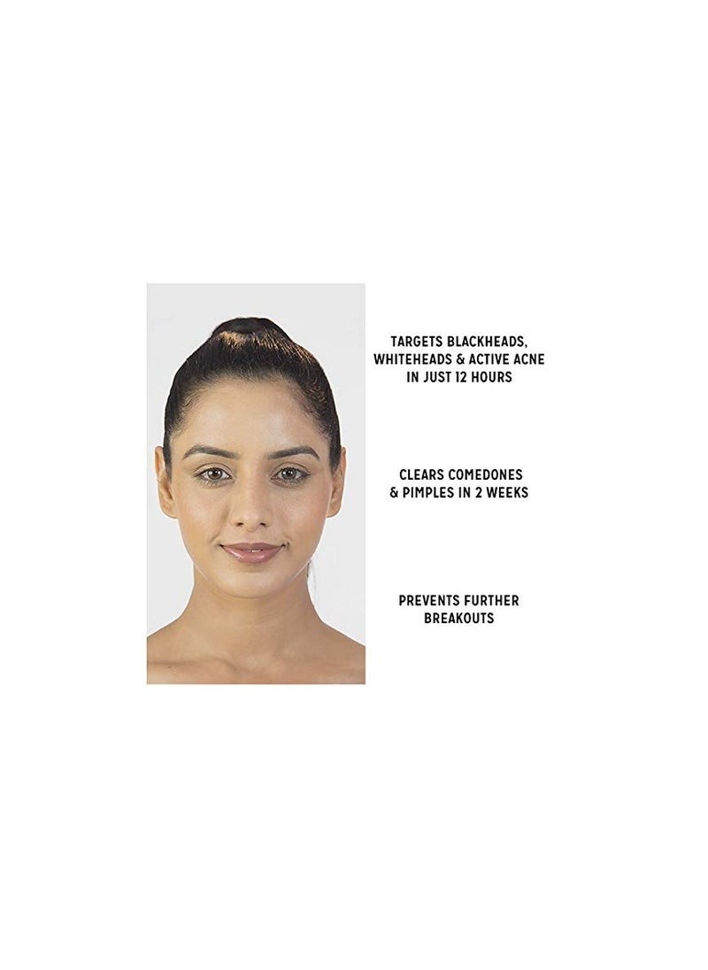 kaya - Kaya Comedone Control Serum 30ml Face Serum Clears Acne Pimples - Image 1