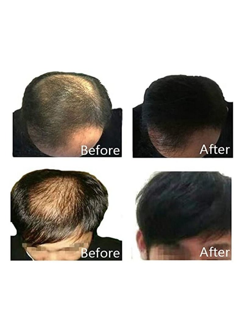Dexe Hair Building Fibers 22g in Light Brown - Image 3