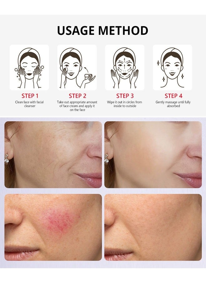 GUANJING Kojic Acid Face Cream 50g,Deep Nourishment Anti Wrinkle Firming Repair Skin Barrier, Improve And Repair Damaged Skin Mildly Whiten Fix Wrinkles, Spots Or Acne Scars In A Effective Way - Image 3
