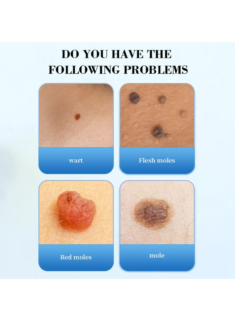 ريفا مزيل الثآليل، إزالة الثآليل سريعة المفعول، لإزالة الزوائد الجلدية على اليدين والجسم، مناسب لمختلف أنواع البشرة - Image 2