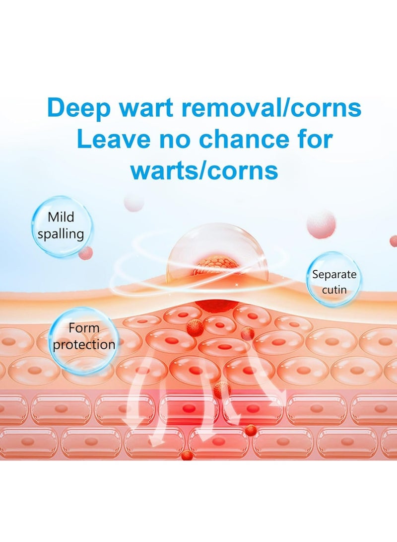 ريفا مزيل الثآليل، إزالة الثآليل سريعة المفعول، لإزالة الزوائد الجلدية على اليدين والجسم، مناسب لمختلف أنواع البشرة - Image 4