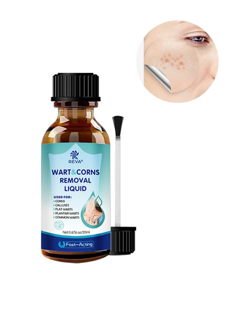 ريفا مزيل الثآليل، إزالة الثآليل سريعة المفعول، لإزالة الزوائد الجلدية على اليدين والجسم، مناسب لمختلف أنواع البشرة - Image 1