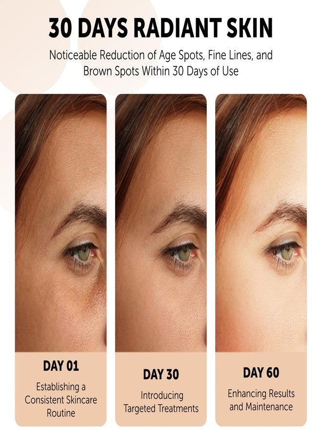 VALITIC Papaya and Turmeric Kojic Acid Soap Bar - Dark Spot Corrector Skin Care Cleansing Bar - Infused with Vitamin C, Hyaluronic Acid - Papaya 2 Pack, Kojic 2 Pack, Holder - Image 3