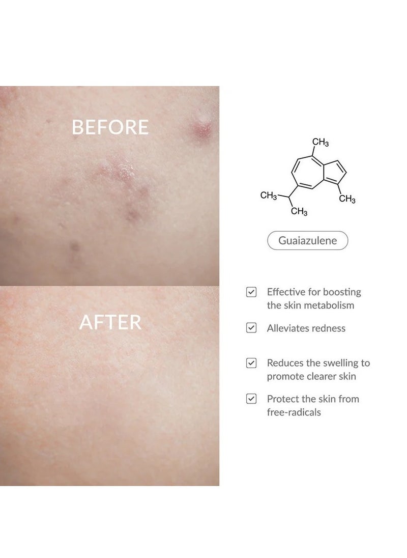 Dr.althea - Dr.Althea 147 Barrier Cream | Daily Skin Barrier Repair Care | Deep Hydrating with Hyaluronic Acid & Ceramides | Korean Vegan Skincare for All Skin Types | 1.7 Fl Oz - Image 1