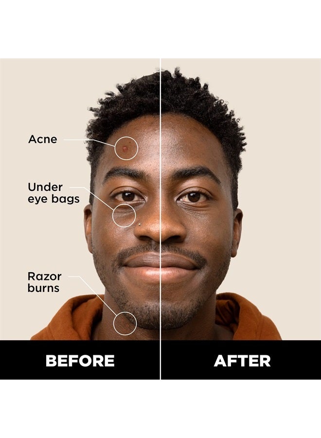 Stryx Concealer Pen Tool for Men, Deep Java - Natural Pigments Hides Imperfections, Acne, Razor Burns, Scars, & Rosacea - Highly Adaptable Shades for Easy, Undetectable Coverage - All Skin Tones  - Image 1