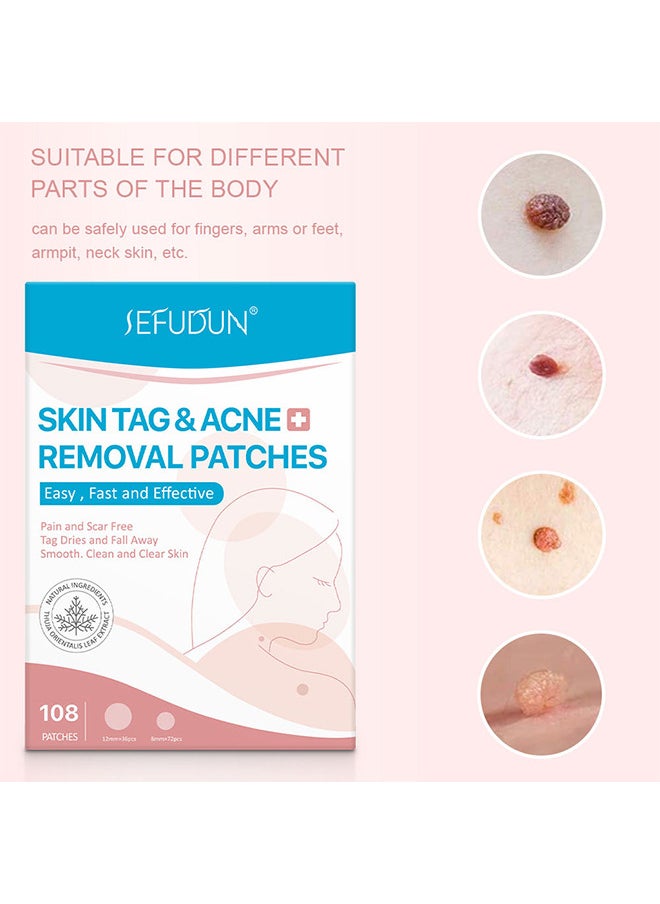 Sefudun - Skin Tag And Acne Removal Patches, Natural Ingredients, Painless Easy To Use Effective Fast Transparent And Ultra-Thin Design Patches For Face And Body 108 Pieces - Image 1
