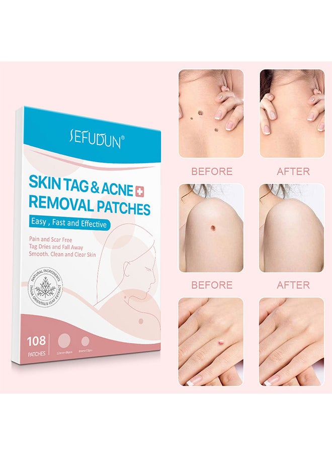 Sefudun - Skin Tag And Acne Removal Patches, Natural Ingredients, Painless Easy To Use Effective Fast Transparent And Ultra-Thin Design Patches For Face And Body 108 Pieces - Image 1