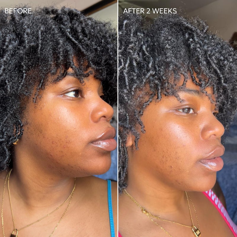 Dermisa Skin Fade Cream with Vitamin C | Helps Reduce Dark Spots and Age Spots | All Skin Types | 1.78 OZ | Pack of 1 - Image 4