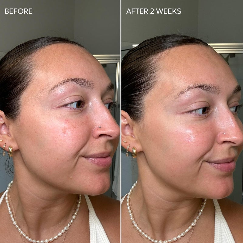 Dermisa Skin Fade Cream with Vitamin C | Helps Reduce Dark Spots and Age Spots | All Skin Types | 1.78 OZ | Pack of 1 - Image 5