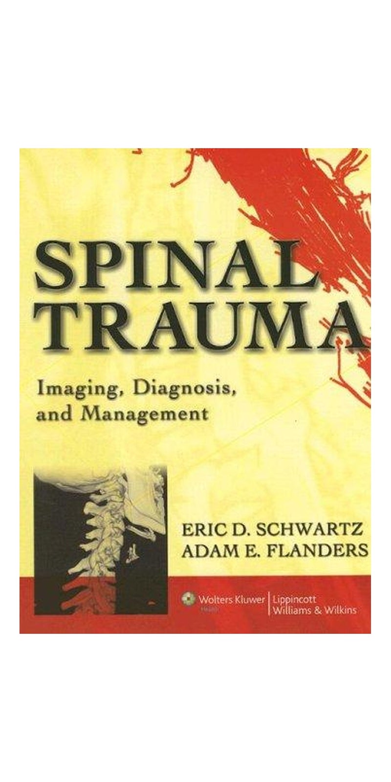 Spinal Trauma: Imaging, Diagnosis, and Management | Hardcover | 1 edition | Published by Lippincott Williams & Wilkins