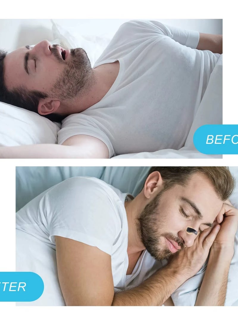 Snoring Solution for Comfortable and Quieter Sleep Effective to Relieve Snoring Anti Snoring Nose Patch Comfortable Anti Snoring Device Suitable for Hotels Homes Business Travel (white-15 pcs) - Image 2