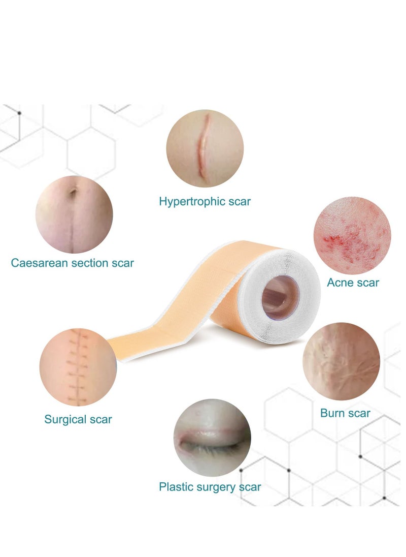 Elaimei - Scar Roll Sticker Self-Adhesive Scar Removal Sticker 4CM*1.5M - Image 1