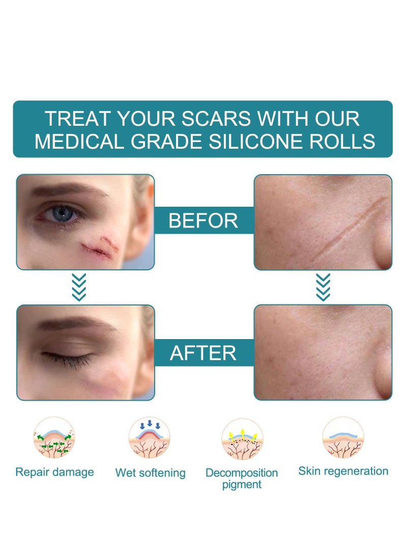 Elaimei - Scar Roll Sticker Self-Adhesive Scar Removal Sticker 4CM*1.5M - Image 1