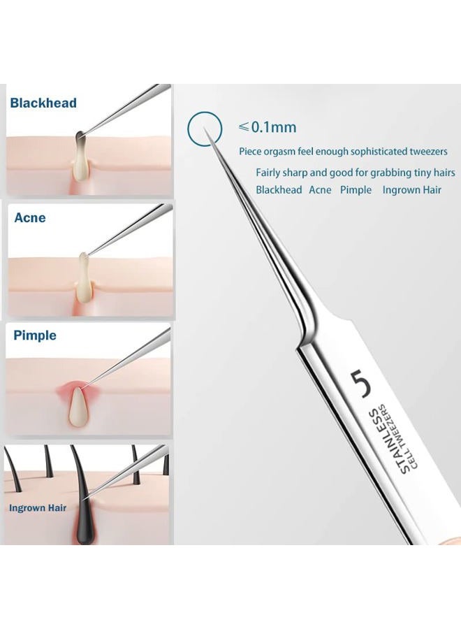 Jedrey Pimple Popper Tool Kit, 2Pcs Professional Facial Blackhead Remover Tweezers and Pimple Extractor Acne Treatment Tool for Acne Pimples Comedowns Blemishes or Splinters Removal - Image 2