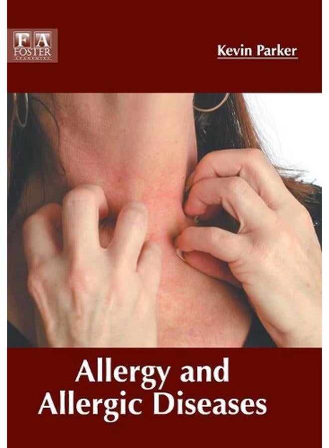 Allergy and Allergic Diseases