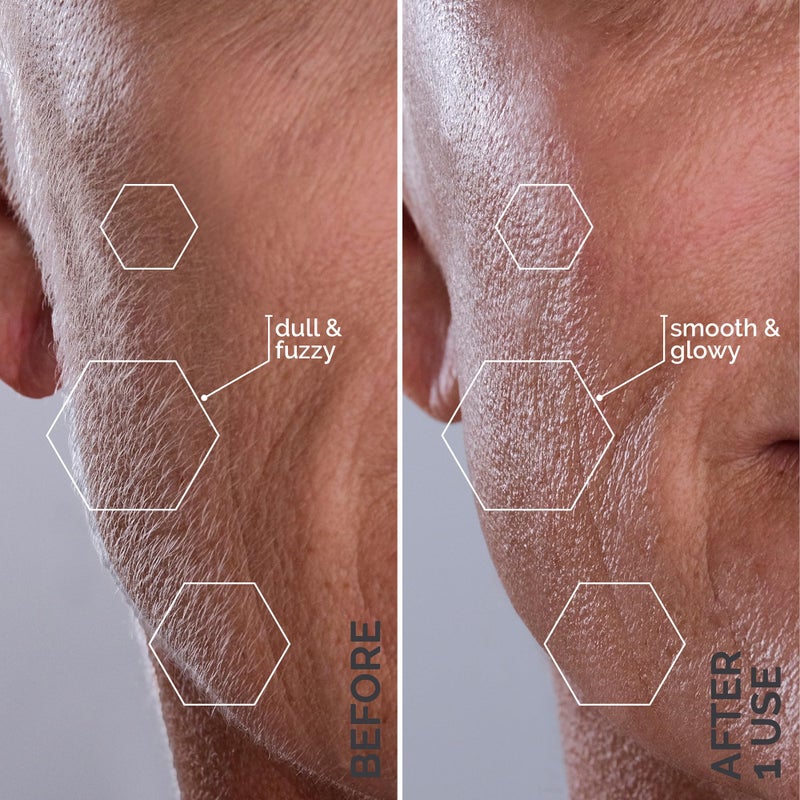 Michael Todd Beauty - Sonicsmooth – SONIC Technology Dermaplaning Tool - 2 in 1 Women’s Facial Exfoliation & Peach Fuzz Hair Removal System with 8 Weeks of Safety Edges - Image 5