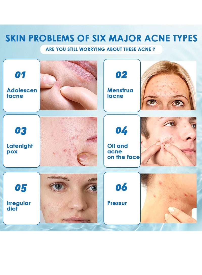 سوميفون كريم لحب الشباب عشبي مضاد لحب الشباب جوهر علاج حب الشباب بثرة مرهم ترطيب مغذي إصلاح الجلد - Image 3