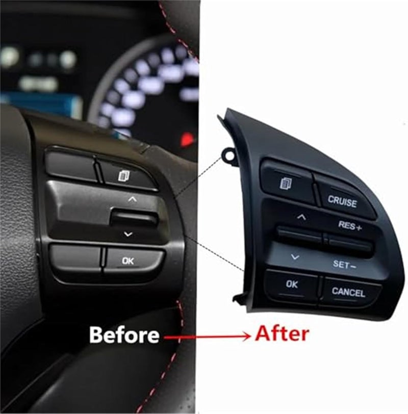 DEMULAX Car Cruise Control Button for Hyundai Elantra - Image 3
