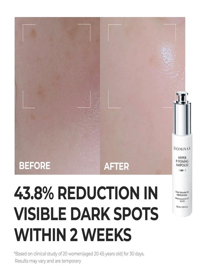 DOMINAS 10% TXA Hyper P-Toning Serum - Discoloration Correcting & Turnover Booster Brightening Serum with 5% AHA, 5% Niacinamide, Pore Care, Dead Skin Cell & Texture, Korean Skincare, 1.01 fl oz - Image 4