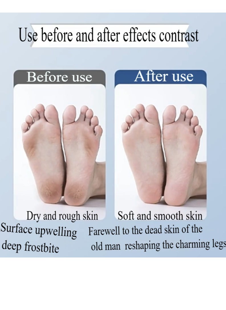 Healife Electric Foot Grinder Electric Callus Remover for Dead Skin and Callus Removal, Electric Foot File Callus Removal Rechargeable Pedicure Tool ,Professional Foot Scraper, Built-in Vacuum Absorption Electric Foot Grinder with Tape Replacement White  - Image 2