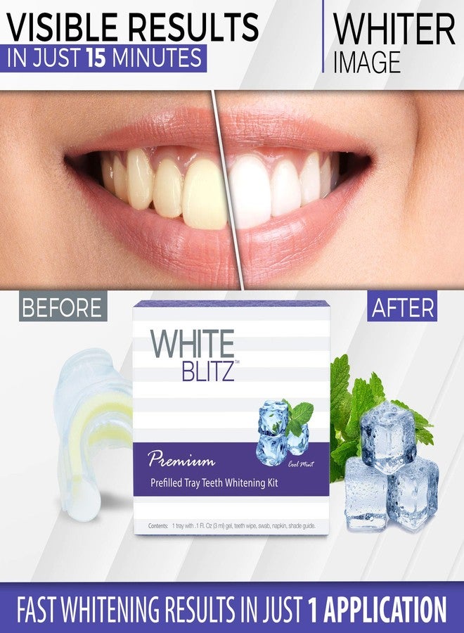 وايتر إيمج مجموعة تبييض الأسنان Whiter Image White Blitz المعبأة مسبقًا مع قالب محكم الإغلاق بالتفريغ، جل تبييض الأسنان + دليل الألوان، بنكهة النعناع المنعش (3 مل) - Image 5