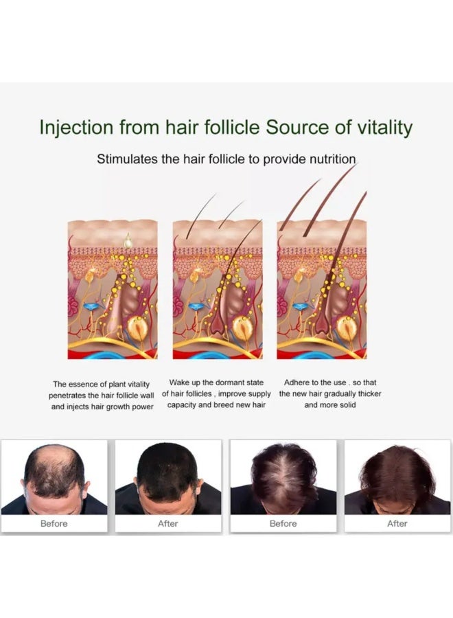 EELHOE بخاخ شعر 50 مل لعلاج تساقط الشعر ورذاذ إنبات الشعر وزيت أساسي لنمو الشعر ورعاية تغذية نمو الشعر ورذاذ زيت النعناع لعلاج فروة الرأس ورذاذ سيروم نمو الشعر ورذاذ مضاد لتساقط الشعر - Image 5