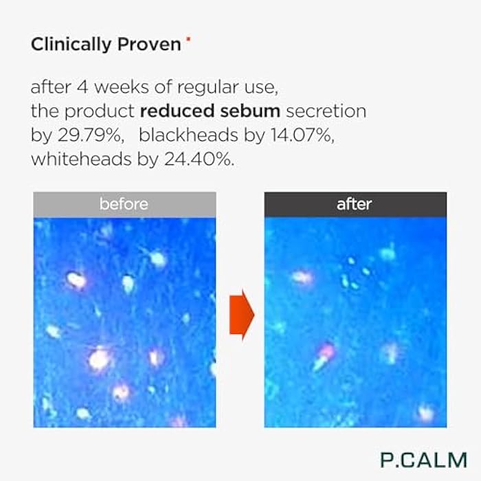 P.CALM تونر باريير من P.CALM - أزولين وسانتيلا أسياتيكا للترطيب العميق وتقوية حاجز البشرة، تونر وجه كوري نباتي للبشرة الحساسة (200 مل / 6.76 أونصة سائلة) - Image 4