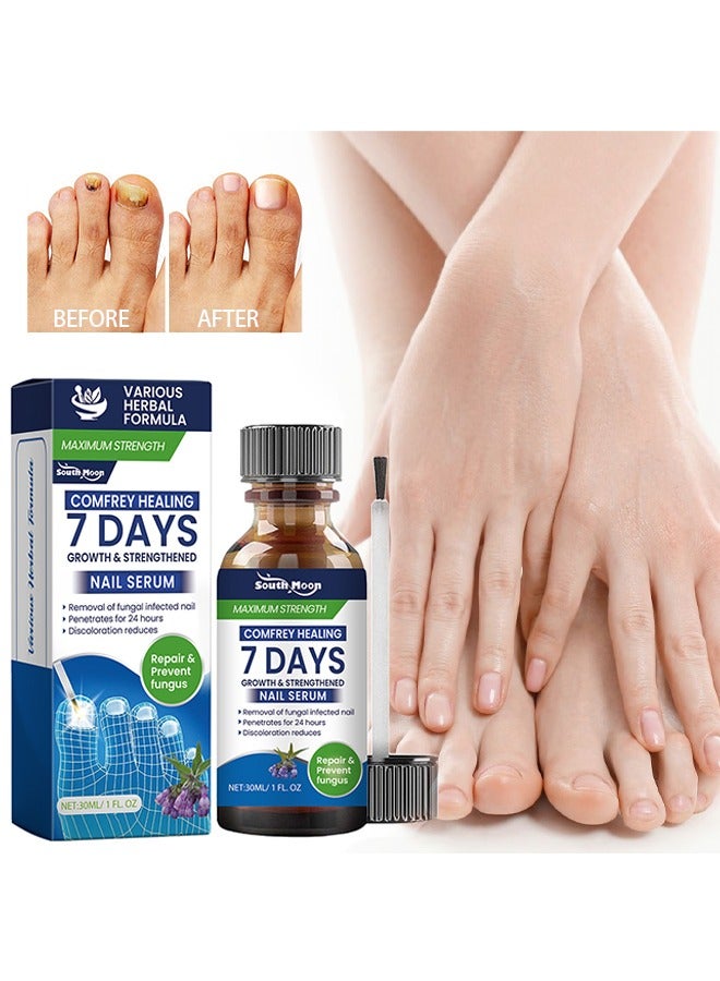 SOUTH MOON 7 Days Nail Serum，Nail Repairserum Nail Cleansing, Gentle Repairof Cuticles, Nail Care And Repairliquid（30ml） - Image 1