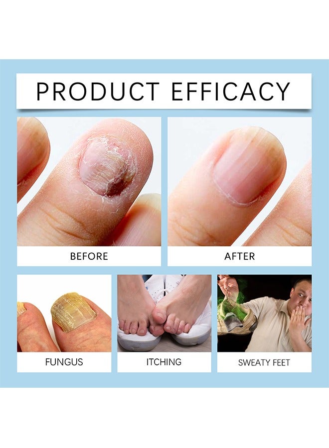 SOUTH MOON 7 Days Nail Serum，Nail Repairserum Nail Cleansing, Gentle Repairof Cuticles, Nail Care And Repairliquid（30ml） - Image 3