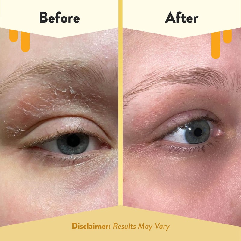 ECZEMA HONEY Multi Peptide Eye Cream - Anti Aging Eye Cream for Dark Circles & Puffiness - Facial Skin Care Products for Eczema, Dry & Sensitive Skin (0.5 Oz) - Image 4