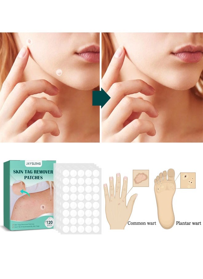 120 Pcs Skin Tag Remover Patches, Made with Natural Ingredients Skin Friendly Breathable and Reliable to Use Fast Use Effect, Compact Design and Lightweight Make It Portable and Space Saving